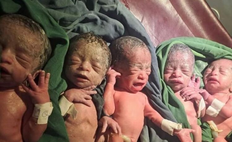 MULHER DÁ À LUZ QUÍNTUPLOS DE FORMA NATURAL APÓS 12 ANOS A TENTAR ENGRAVIDAR NA ETIÓPIA